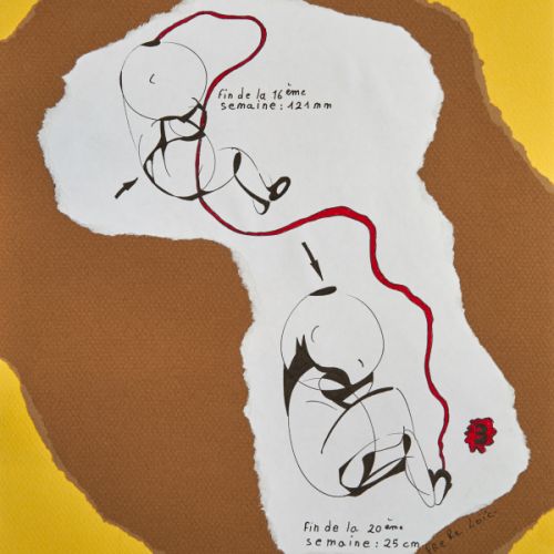 N° 183 - Taille du fœtus III - 1997 (23,9 x 31,9 cm)